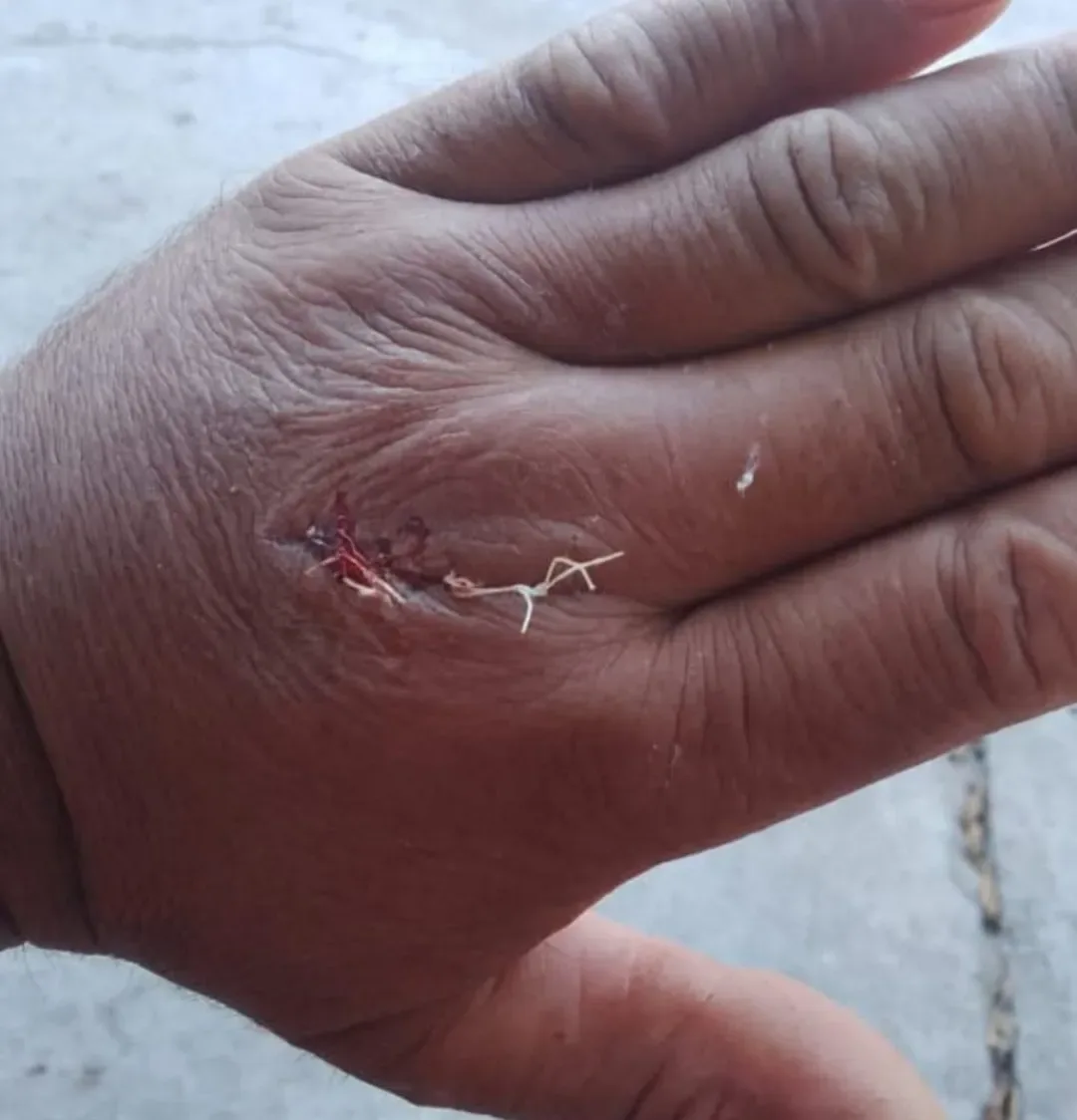 Atacó a machetazos a un puestero en Ancasti: lo busca la policía