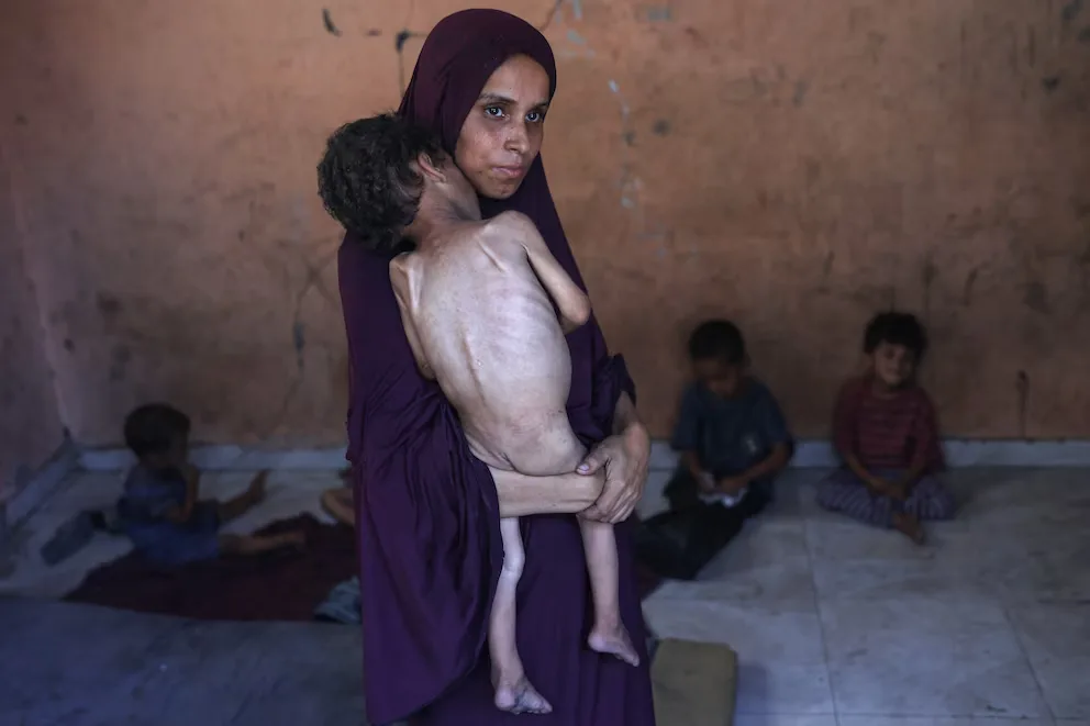 Niños, jóvenes, ancianos y enfermos mueren de hambre en Gaza: “No hay nada”