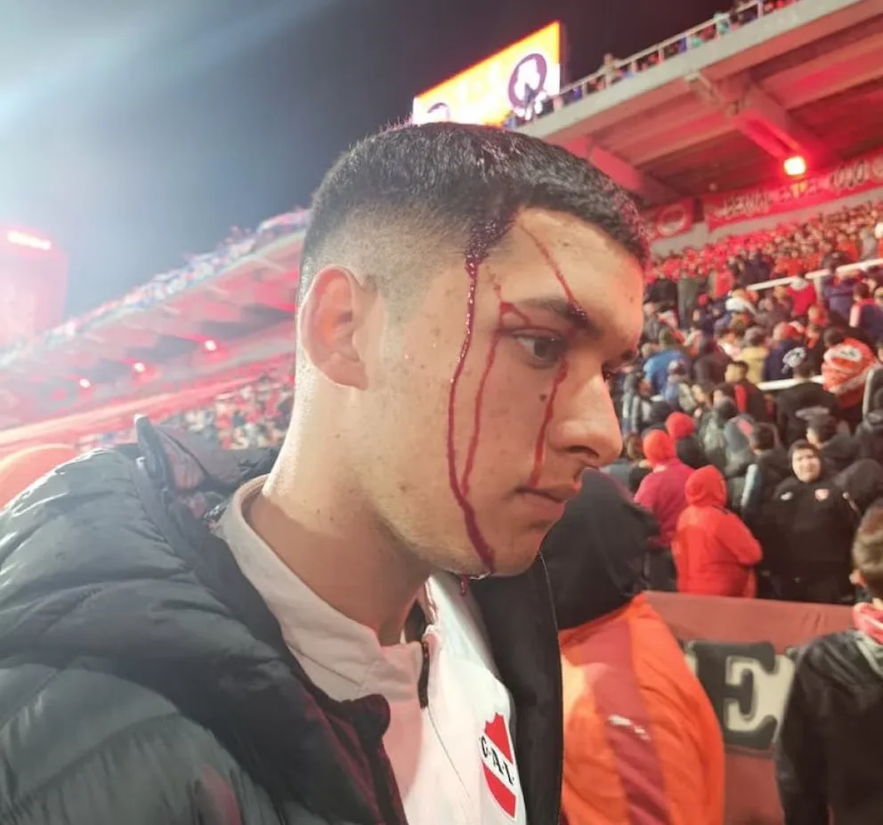 Se suspendió por incidentes el partido entre Independiente y la “U” de Chile por la vuelta de octavos de la Sudamericana