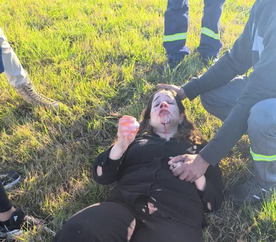Una diputada sufrió un fuerte accidente porque se durmió el chofer