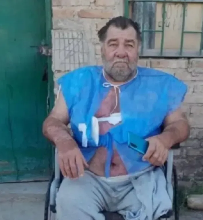Un vecino en silla de ruedas denunció venta de drogas y lo atacaron con agua hirviendo