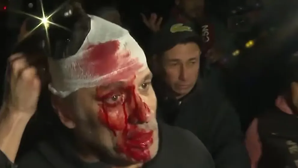 Incidentes en el acto de LLA en Moreno: peleas entre militantes, un botellazo a un periodista y piedras al auto presidencial