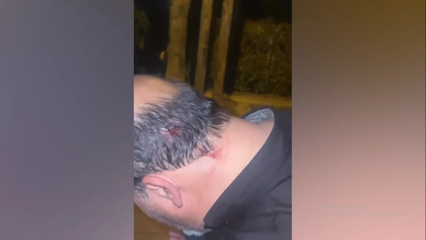 Le dispararon al menos dos veces a chofer de App, uno de los tiros le atravesó el antebrazo y otro lo impactó en el pecho: mató a un delincuente