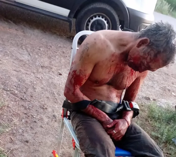 Casi mata a su tío al descubrir una infidelidad con su pareja: lo ató y golpeó con un palo con clavos